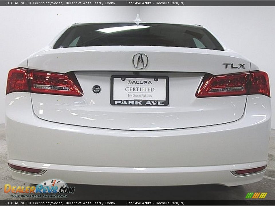 2018 Acura TLX Technology Sedan Bellanova White Pearl / Ebony Photo #2