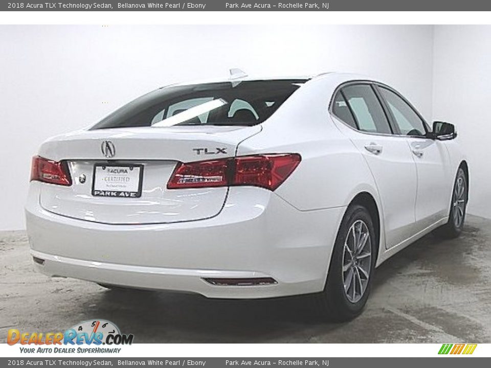 2018 Acura TLX Technology Sedan Bellanova White Pearl / Ebony Photo #3
