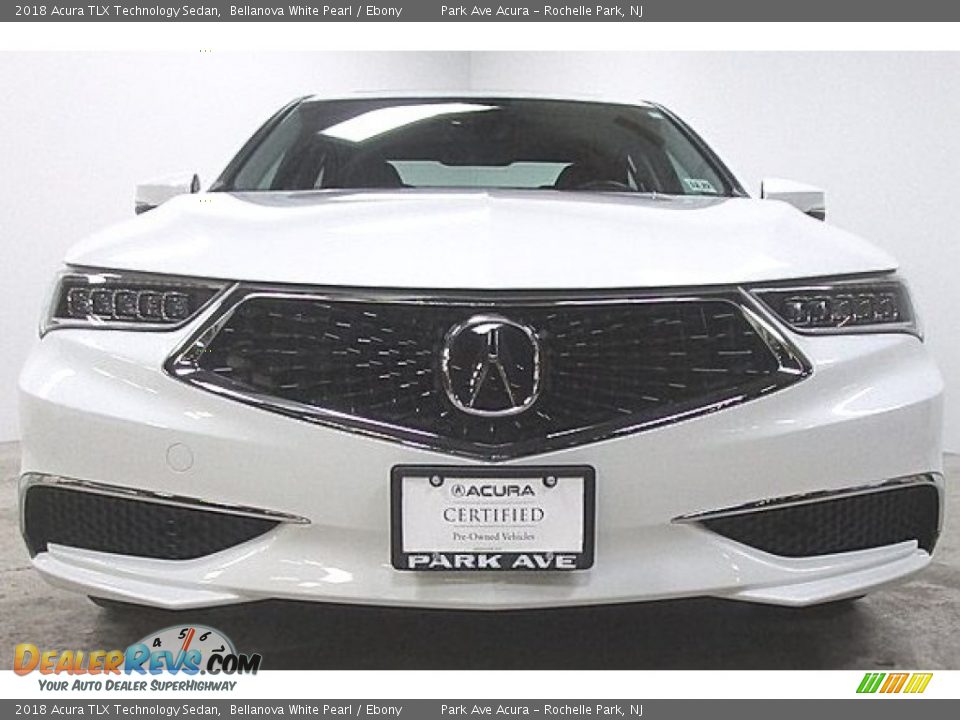 2018 Acura TLX Technology Sedan Bellanova White Pearl / Ebony Photo #4