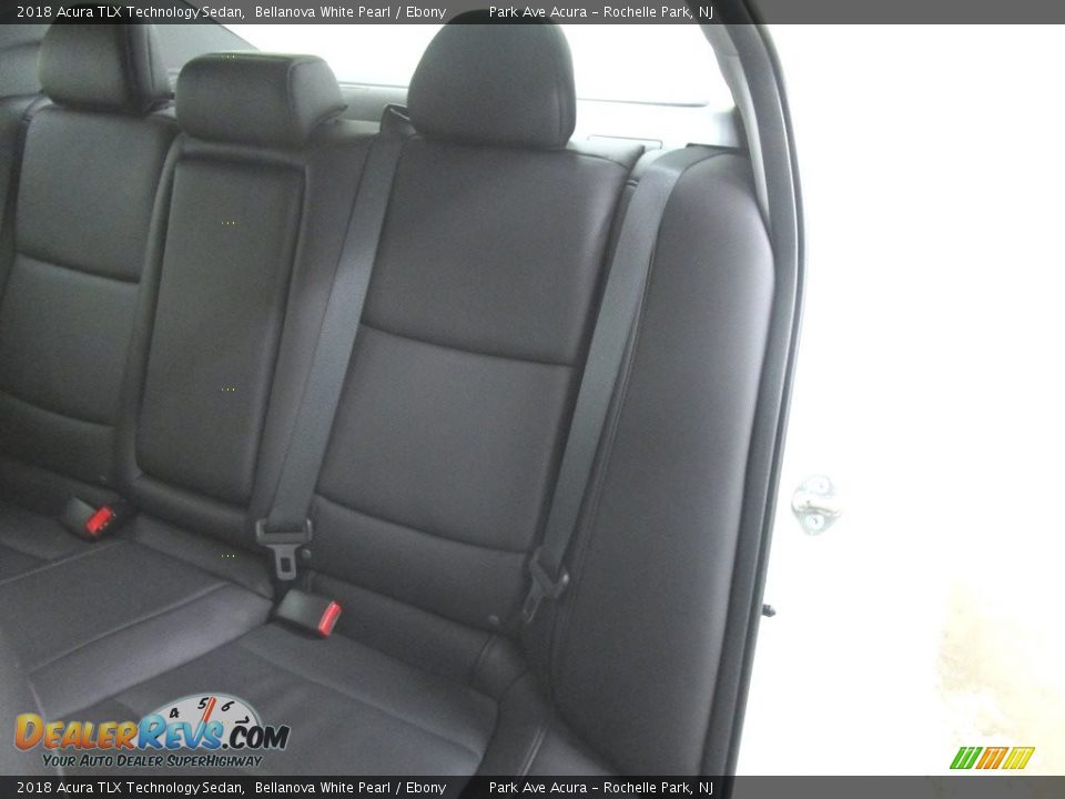 2018 Acura TLX Technology Sedan Bellanova White Pearl / Ebony Photo #9