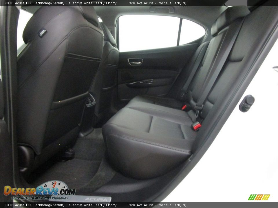 2018 Acura TLX Technology Sedan Bellanova White Pearl / Ebony Photo #10