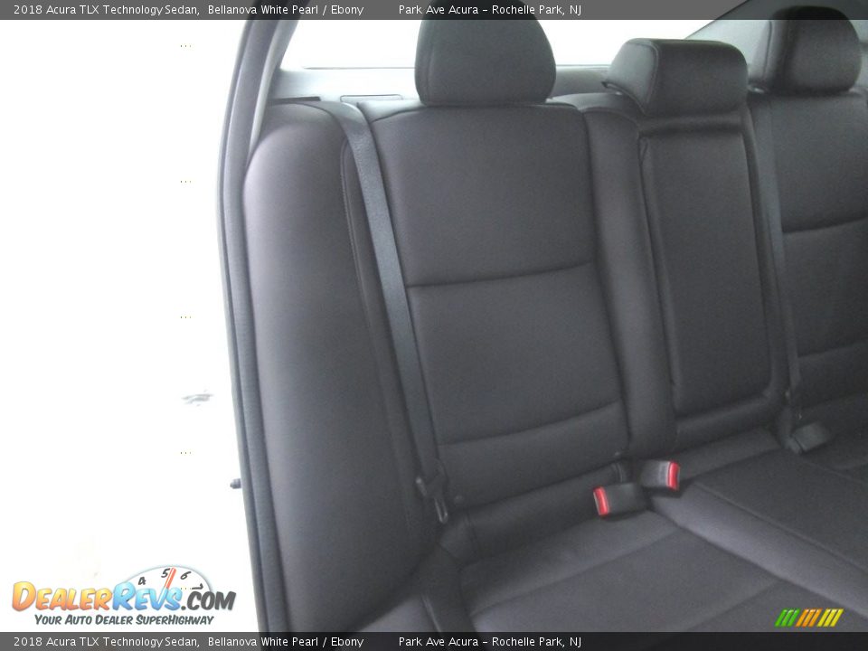 2018 Acura TLX Technology Sedan Bellanova White Pearl / Ebony Photo #15