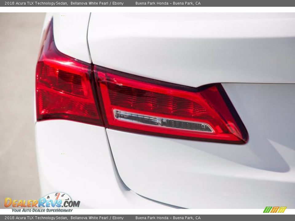 2018 Acura TLX Technology Sedan Bellanova White Pearl / Ebony Photo #12