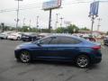 2017 Elantra SE #3 2017 Elantra SE #3