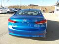 2017 Elantra SE #7 2017 Elantra SE #7