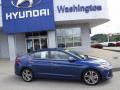 2017 Elantra Limited #2 2017 Elantra Limited #2