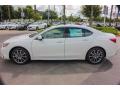 2018 TLX V6 Technology Sedan #4 2018 TLX V6 Technology Sedan #4
