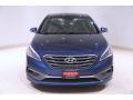 2016 Sonata Sport #2