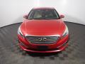 2017 Sonata SE #5 2017 Sonata SE #5